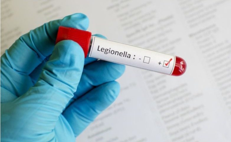 Zagrożenie Legionellą w czasach COVID-19. Metody dezynfekcji instalacji